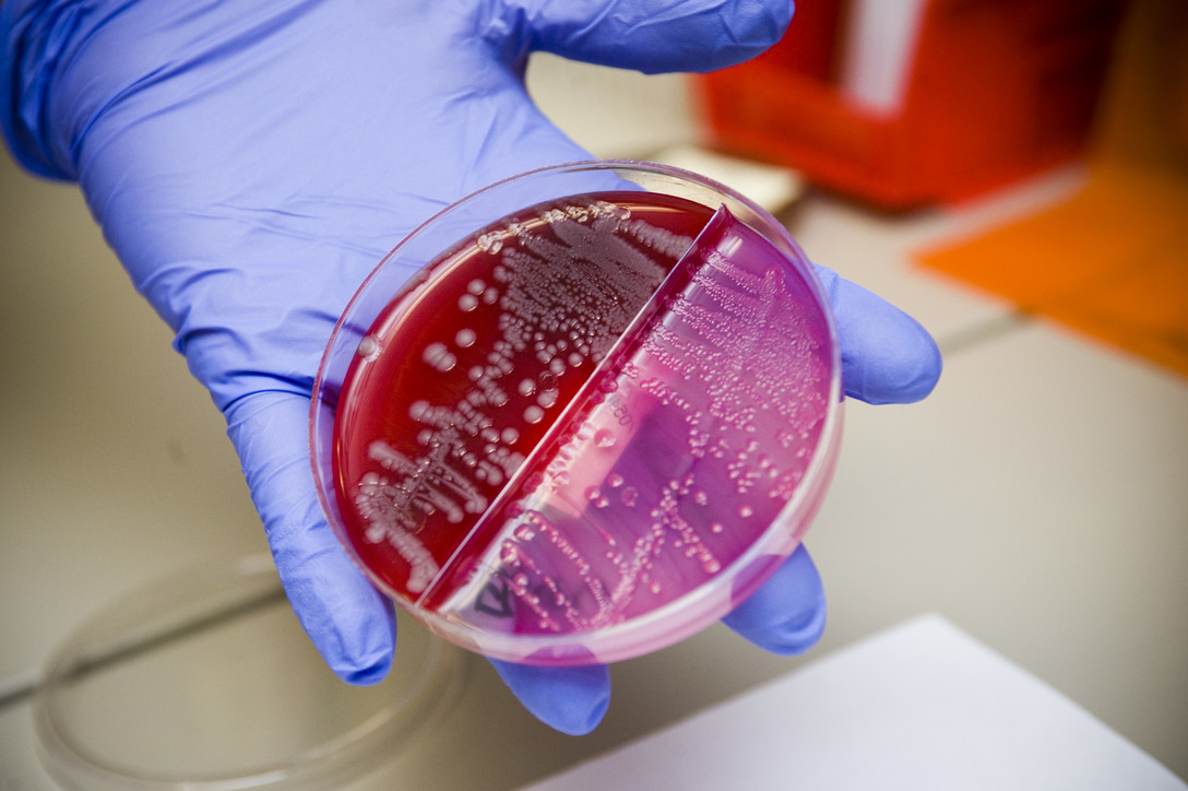 gloved hand holding stained petri dish to show a randomised controlled trial